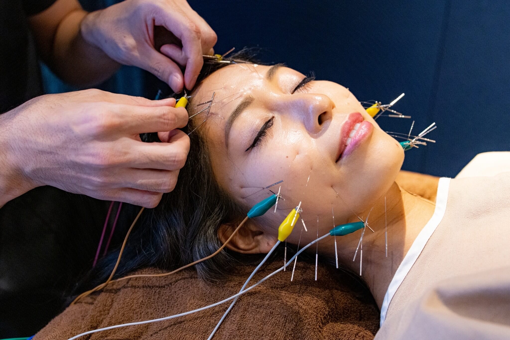 京都で電気を流す美容鍼なら鍼灸サロン孔-KOH-